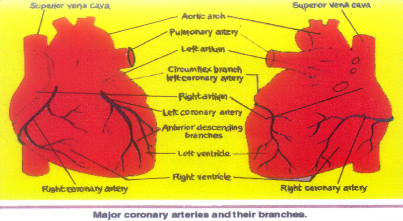 File:Ischemic Heart Disease.PNG